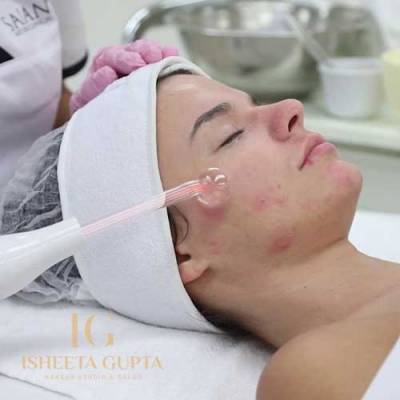 Acne Treatment Facial in Ghitorni