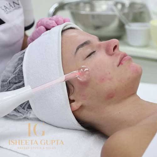 Acne Treatment Facial in Madipur